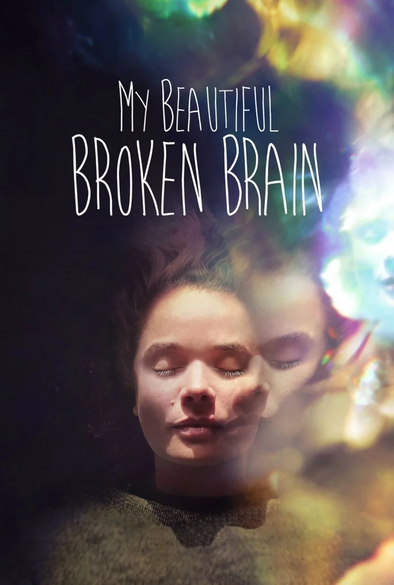 Poster van My Beautiful Broken Brain